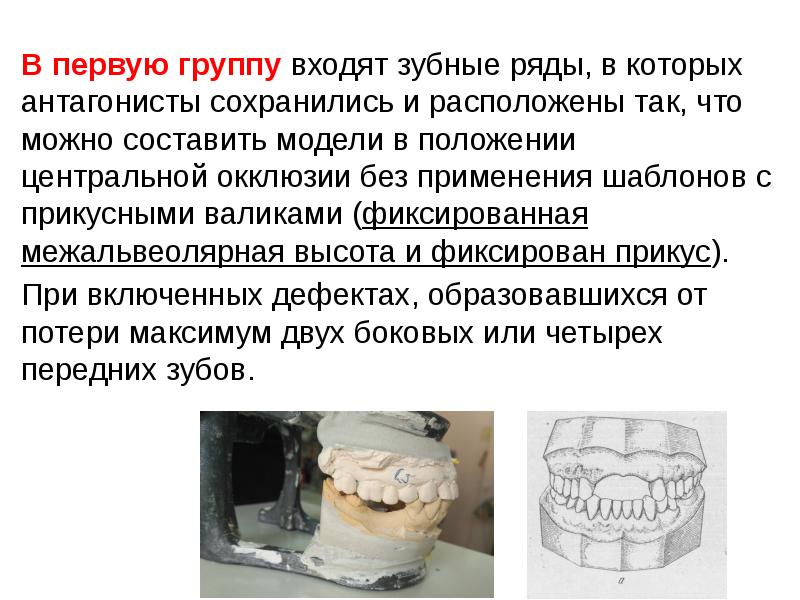 Презентация методы определения центрального соотношения челюстей