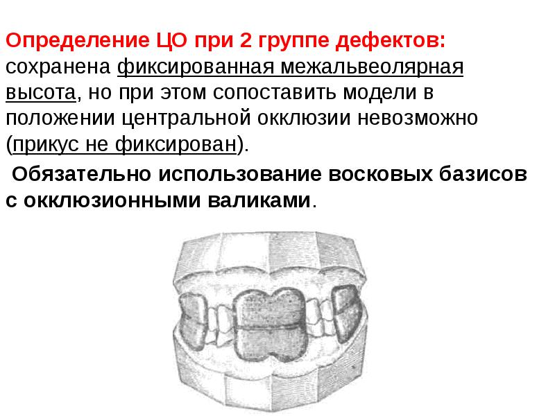 Центральная окклюзия и центральное соотношение челюстей презентация