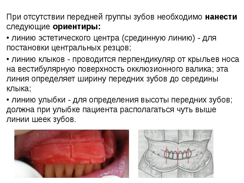 Центральная окклюзия и центральное соотношение челюстей презентация