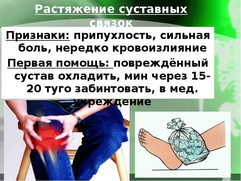 Растяжение связок симптомы