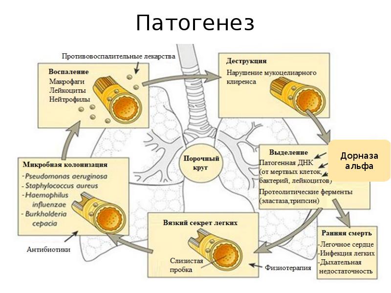 Бронхоэктатическая болезнь презентации