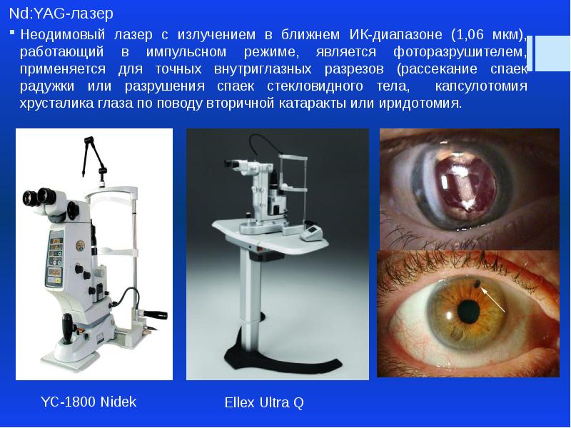 Лазеры в офтальмологии презентация
