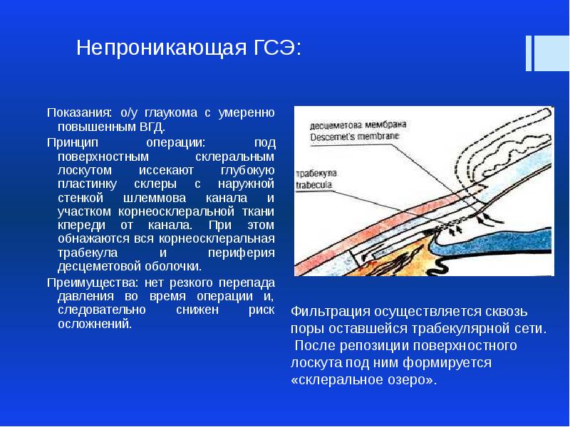 Применение лазеров в офтальмологии презентация