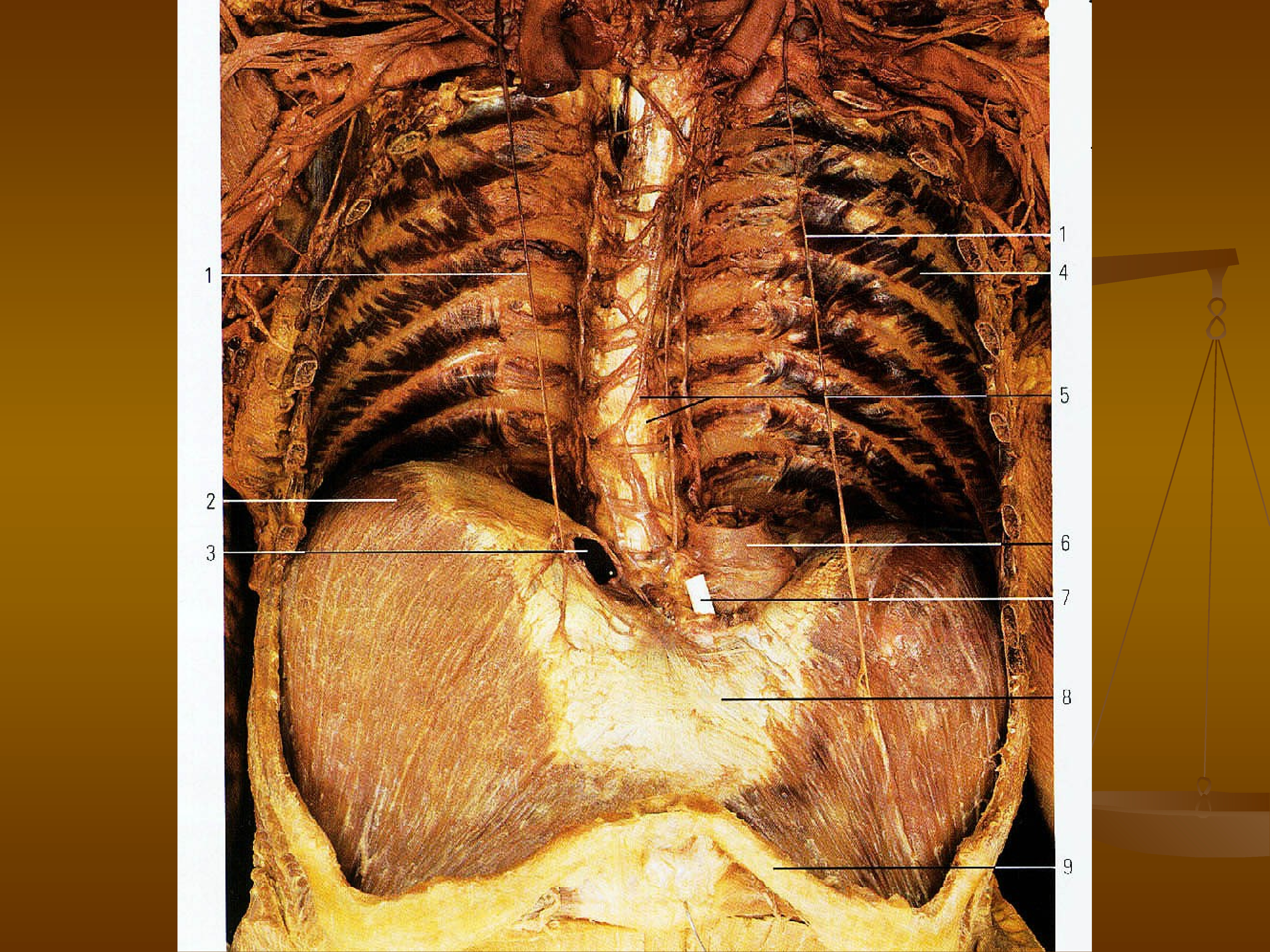 Диафрагмальный нерв является ветвью. Двигательные нервы шейного сплетения. Топография диафрагмального нерва топографическая анатомия. Шейное сплетение анатомия. Шейное сплетение таблица иннервации.