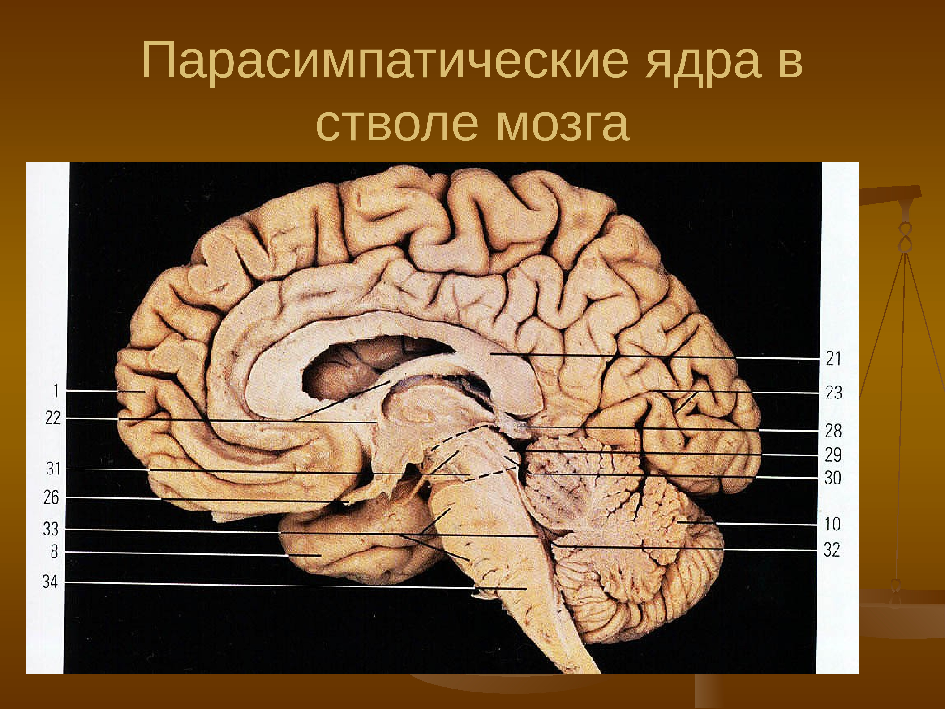 Сагиттальный разрез мозга. 4 Желудочек головного мозга на сагиттальном разрезе. Свод мозга анатомия. Шпорная борозда мозга. Сагиттальный разрез мозга препарат.