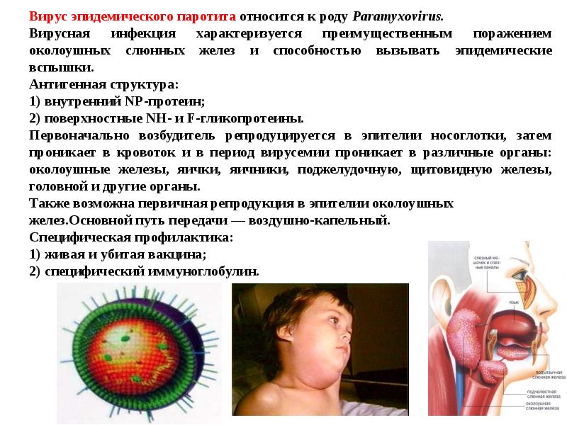 Больных вирусом. Антигенная структура вируса эпидемического паротита. Эпидемический паротит антигенная структура. Вирус эпидемического паротита морфология. Эпидемический паротит клиническая картина.