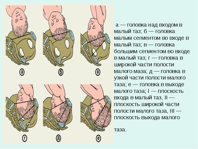 Расположение головки плода по данным акушерского исследования