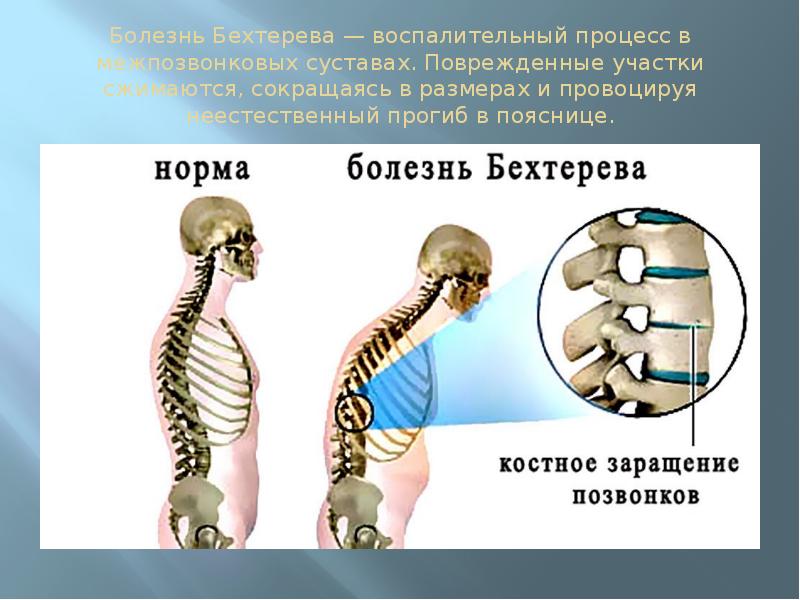 Болезнь дегтярева описание и фото