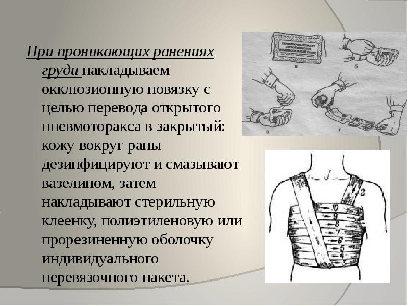 При проникающих ранениях груди. Наложение повязки при проникающих ранениях. Особенности наложения повязок при проникающих ранениях груди. Наложение повязки при проникающем ранении грудной клетки. Окклюзионная повязка при проникающем ранении грудной клетки.