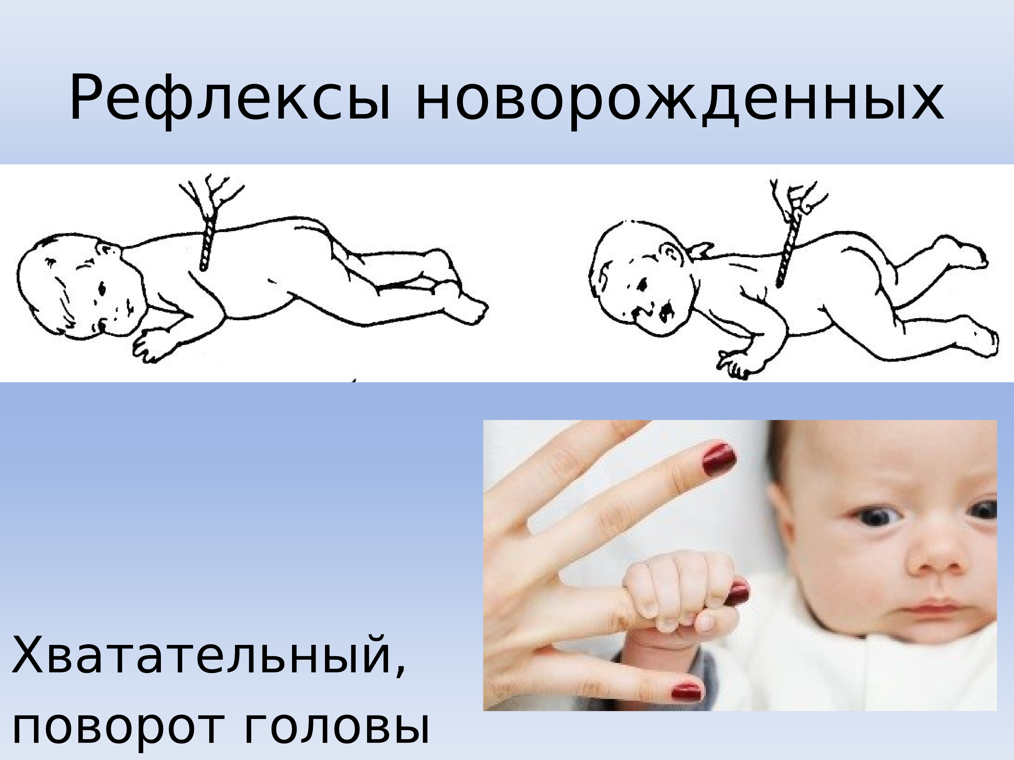 Врожденными являются рефлексы. Рефлексы новорожденного Бабинского Моро. Безусловные рефлексы сосательный рефлекс. Условные рефлексы новорожденного ребенка. Безусловные рефлексы ребенка.