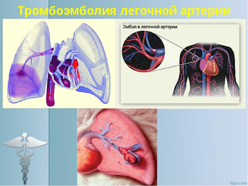 Патофизиология дыхательной системы презентация