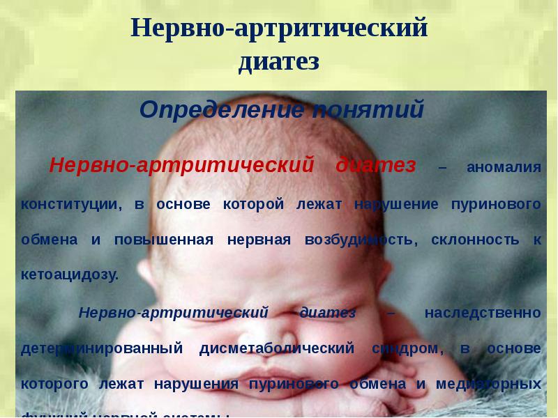 Аномалии Конституции у детей. Нервно-артритический диатез. Нервно-артритический диатез у детей. Нервно-артритический диатез осложнения.