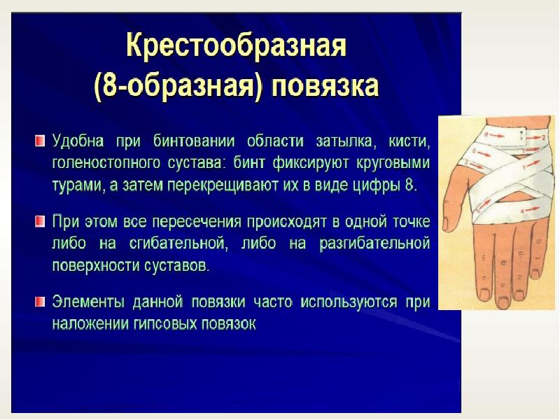 Десмургия презентация по хирургии