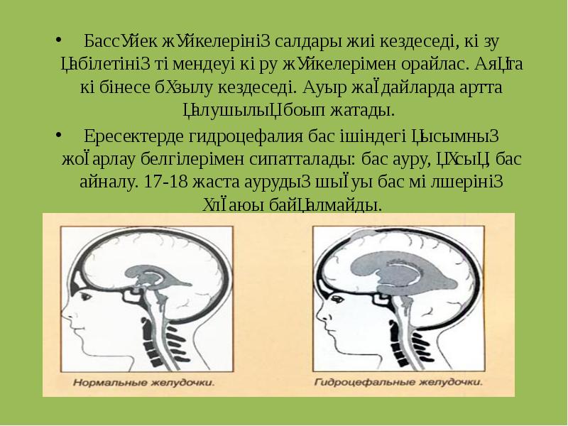 Бассүйек жүйкелерінің салдары жиі кездеседі, көзу қабілетінің төмендеуі көру жүйкелерімен орайлас. Бассүйек жүйкелерінің салдары жиі кездеседі, көзу қабілетінің төмендеуі көру жүйкелерімен орайлас.