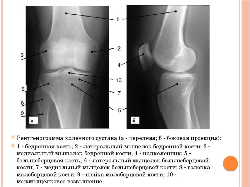 Наружный мыщелок большеберцовой кости фото