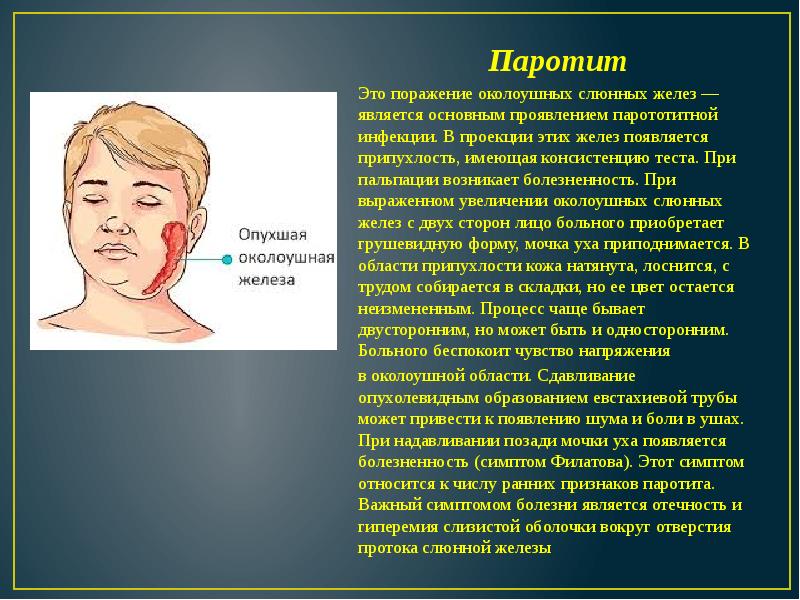 Паротит Паротит Это поражение околоушных слюнных желез — является основным проявлением