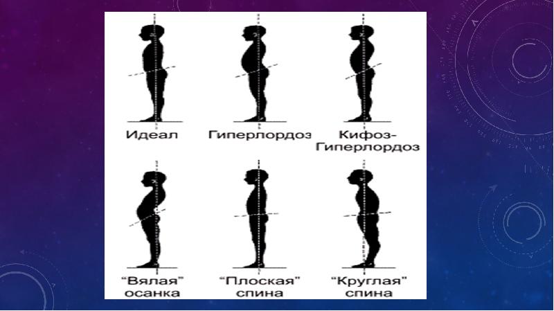 Презентация на тему хорошая осанка красота и здоровье на всю жизнь