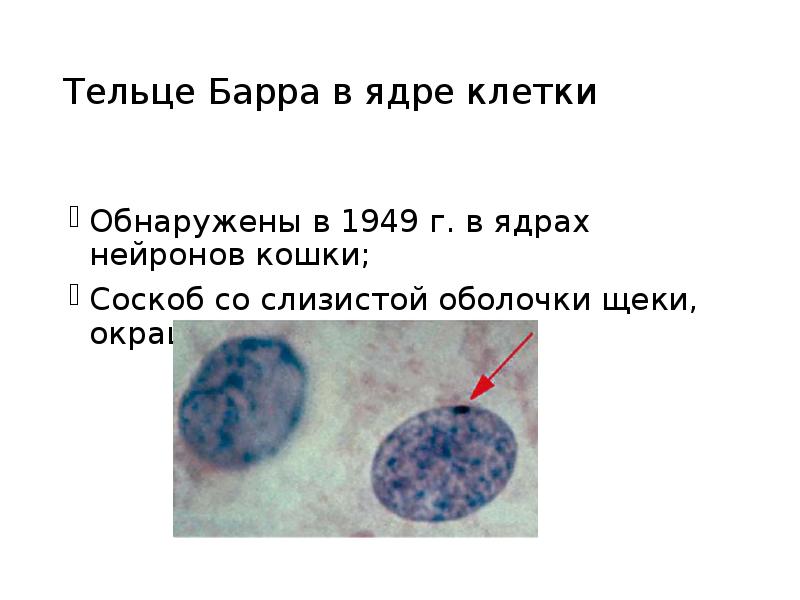 Синдром шерешевского тернера тельце барра