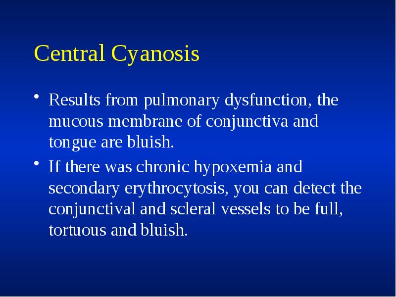 Central Cyanosis
Results from pulmonary dysfunction, the mucous membrane of conjunctiva Central Cyanosis
Results from pulmonary dysfunction, the mucous membrane of conjunctiva