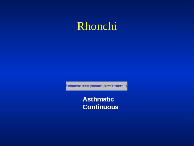 Rhonchi Rhonchi