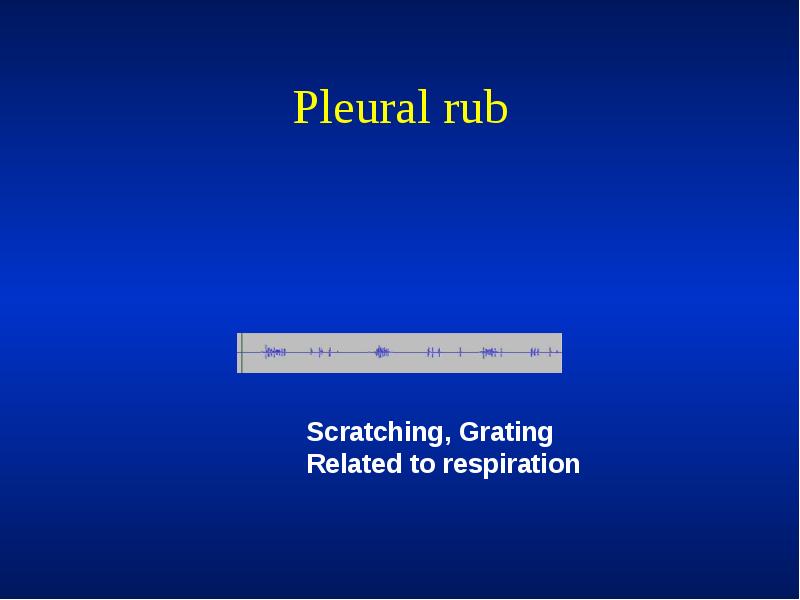 Pleural rub Pleural rub