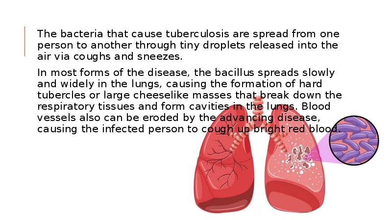 The bacteria that cause tuberculosis are spread from one person to The bacteria that cause tuberculosis are spread from one person to