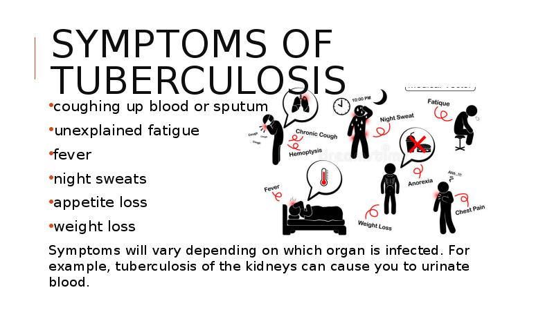 symptoms of tuberculosis
 coughing up blood or sputum
 unexplained fatigue
 fever
 symptoms of tuberculosis
 coughing up blood or sputum
 unexplained fatigue
 fever