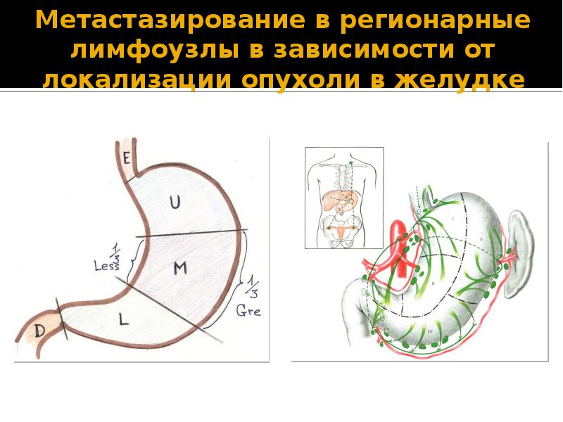 Лимфоотток желудка схема