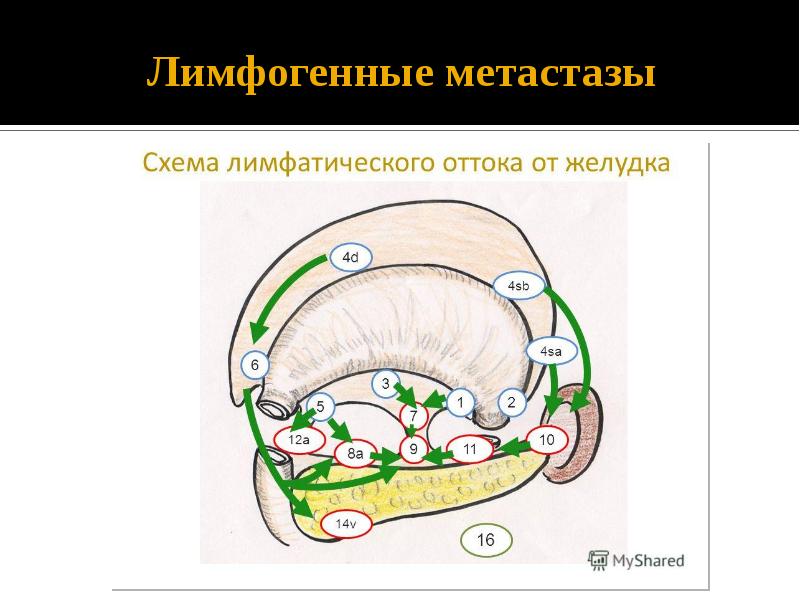 Лимфатические узлы желудка схема