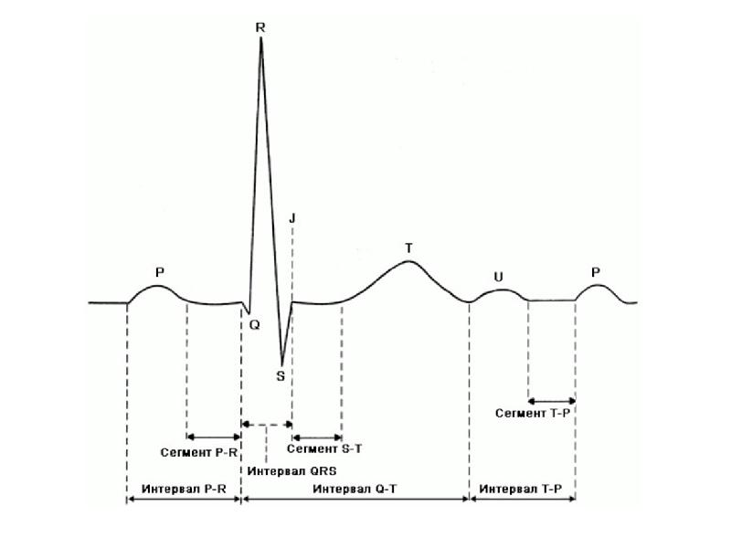 Коррегирование qt калькулятор. Интервал qt на ЭКГ норма таблица. Зубцы Осборна ЭКГ. Интервал PR на ЭКГ. Расчета корригированного интервала qt ЭКГ норма.