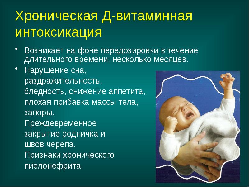 Хроническая Д-витаминная интоксикация
Возникает на фоне передозировки в течение длительного Хроническая Д-витаминная интоксикация
Возникает на фоне передозировки в течение длительного