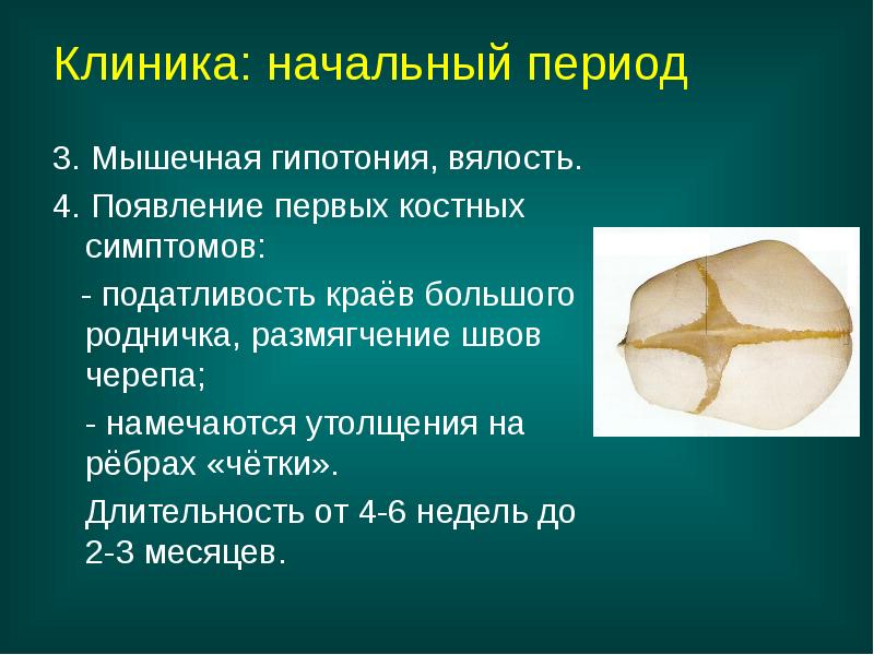 Клиника: начальный период
3. Мышечная гипотония, вялость.
4. Появление первых костных Клиника: начальный период
3. Мышечная гипотония, вялость.
4. Появление первых костных