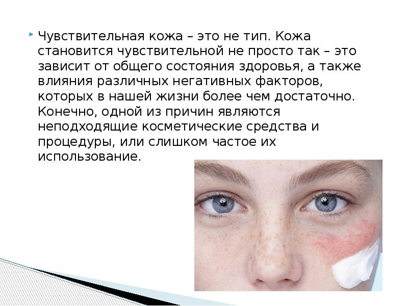 Чувствительная кожа&nbsp;– это не тип. Кожа становится чувствительной не просто так