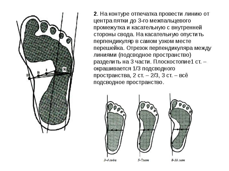 Массаж при плоскостопии презентация