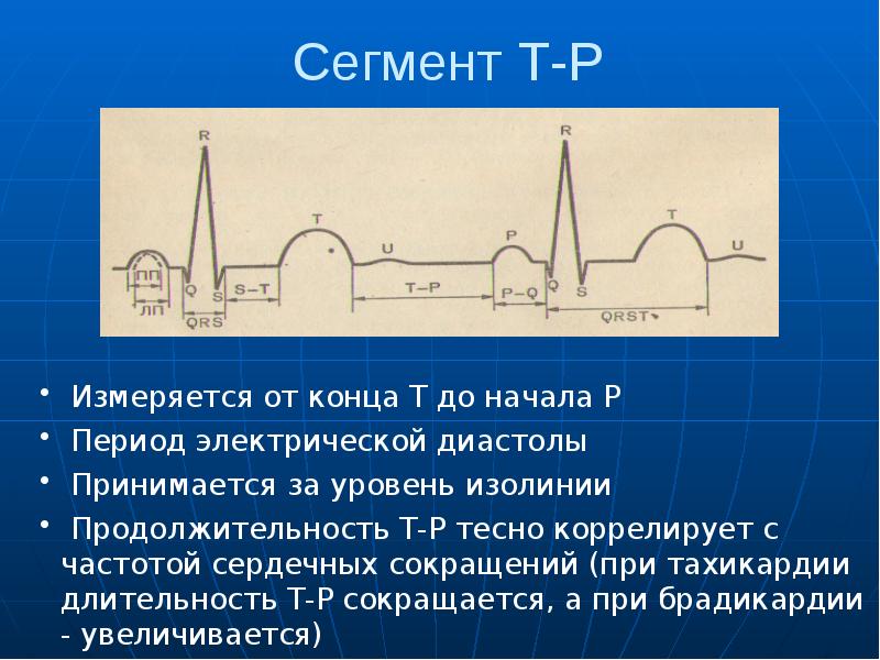 Основы экг презентация