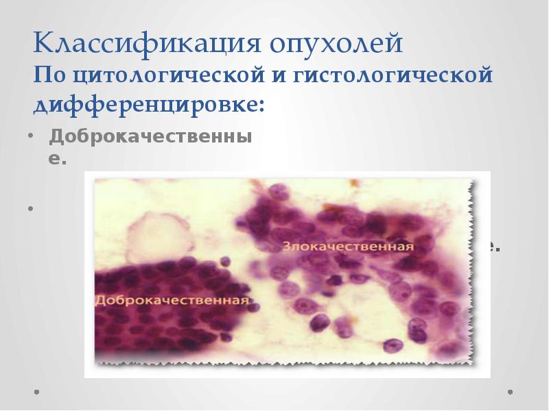 гистологическая классификация злокачественных опухолей, классификация опухолей патофизиология, дифференцировка доброкачественных и злокачественных опухолей, опухоли презентация патофизиология