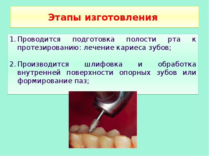 Протез презентация