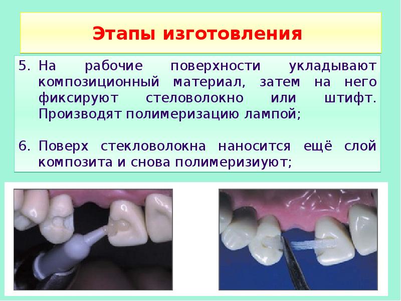 Презентация по реставрации