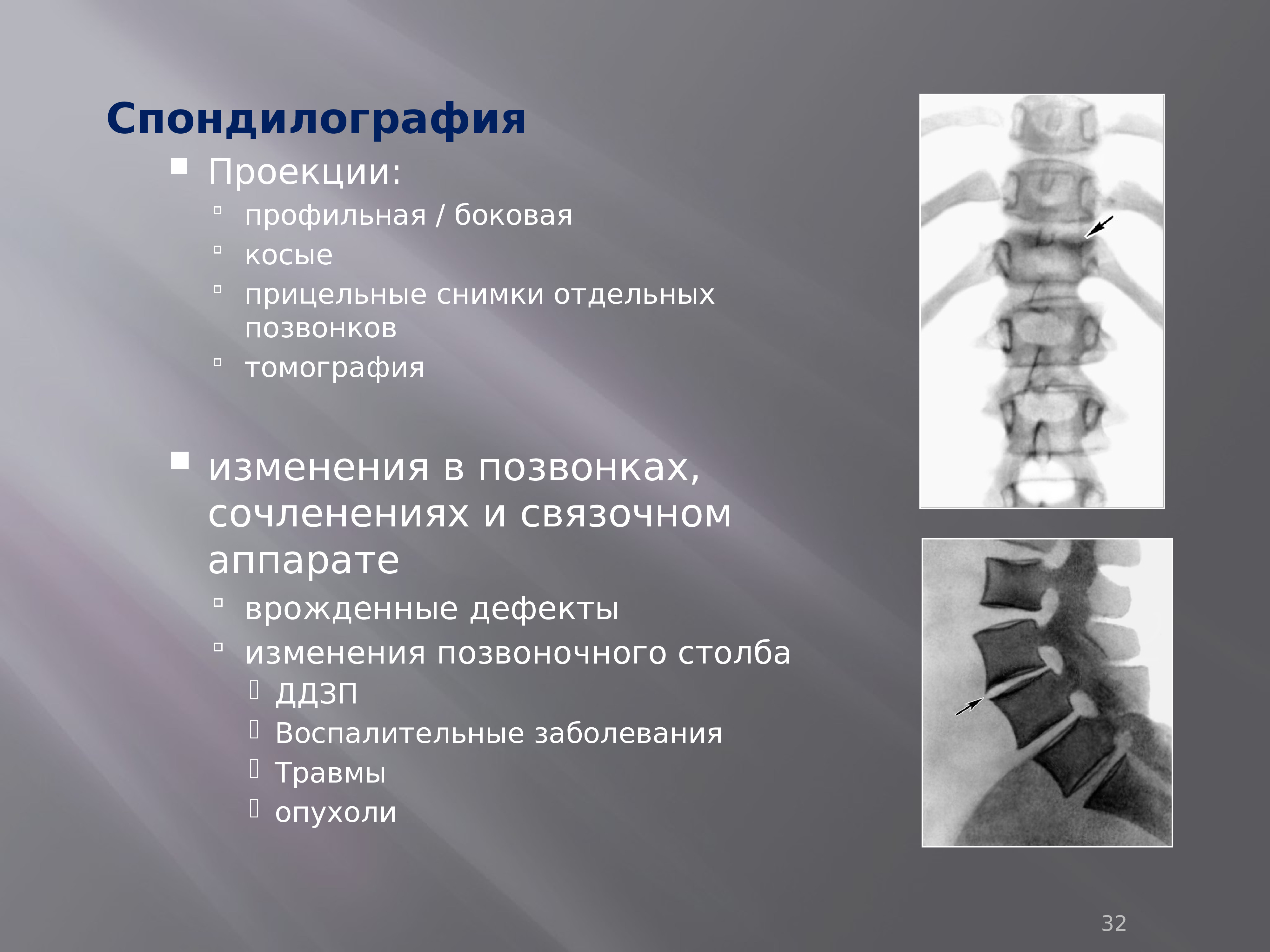 спондилография методы исследования. спондилоартроз поясничного отдела рентген. функциональная спондилография. обзорная спондилография. спондилография (рентген позвоночника).