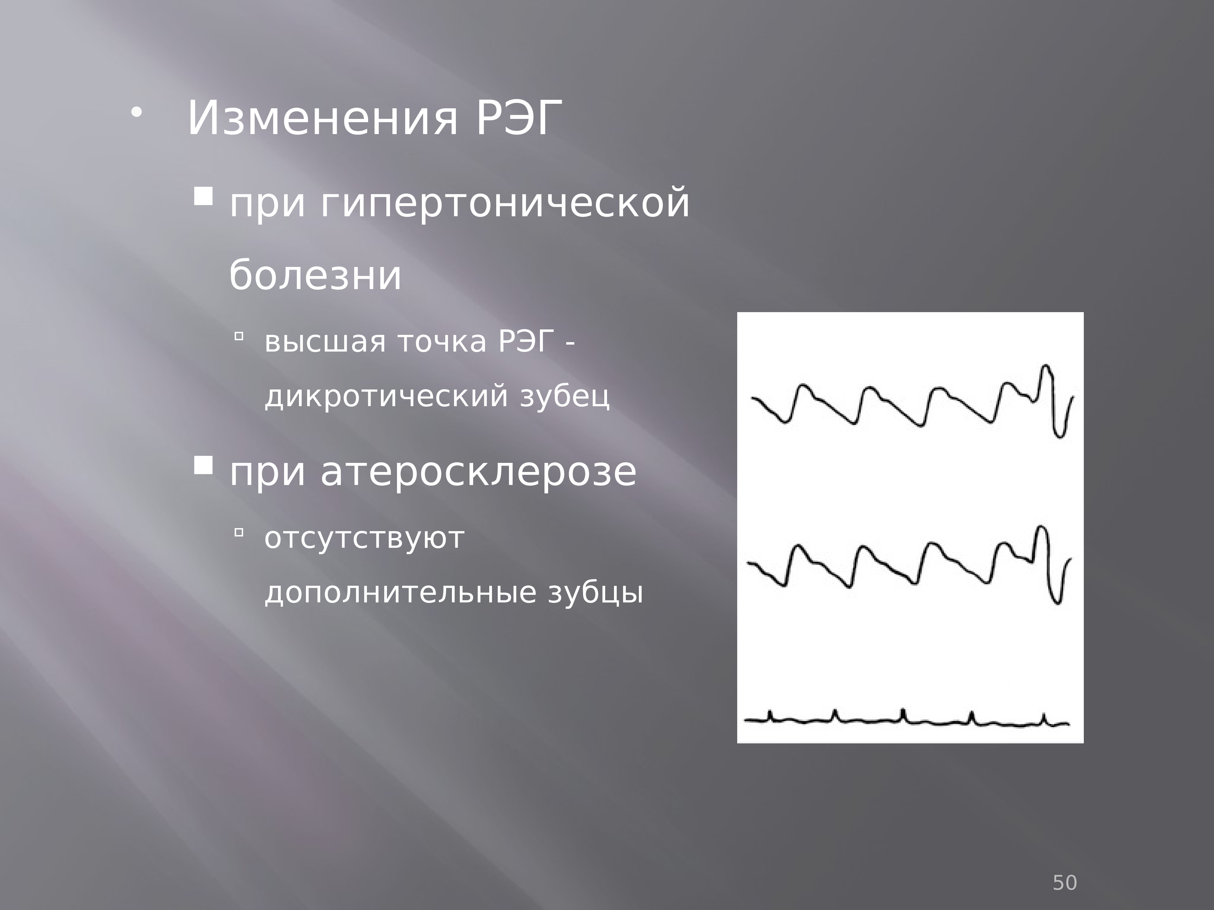 Гипертонический тип рэг схема. Гипертонический тип рэг схема. Гипертонический тип рэг схема. Рэг сосудов. Гипертонический тип рэг схема.