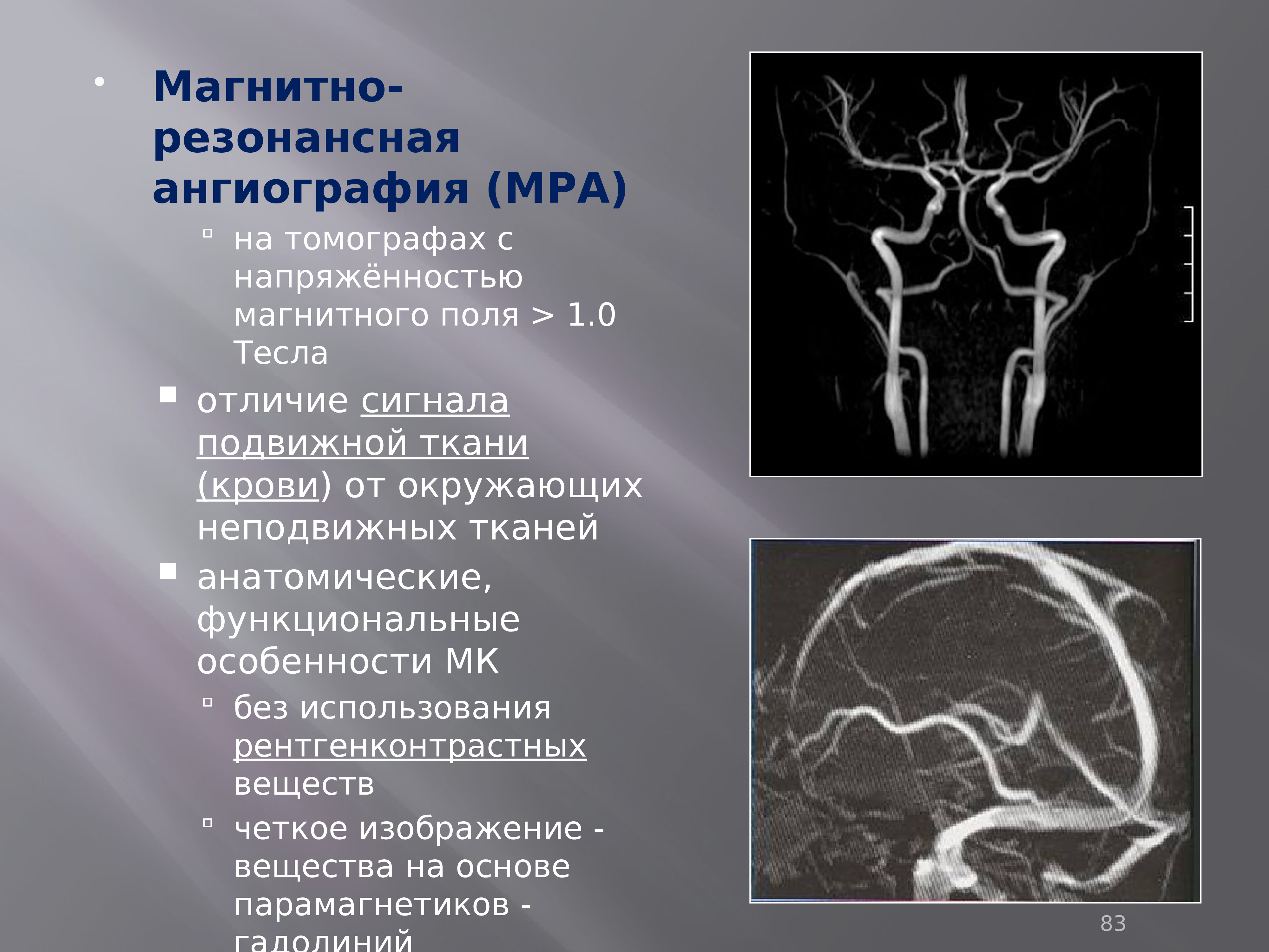 Ангиография это. МРА (магнитно-резонансная ангиография). Структуры на ангиографии. Кт ангиография методика. Ангиография принцип метода.