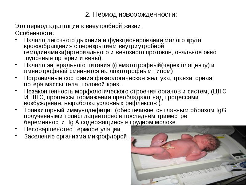 2. Период новорожденности:
Это период адаптации к внеутробной жизни.
Особенности:
Начало 2. Период новорожденности:
Это период адаптации к внеутробной жизни.
Особенности:
Начало