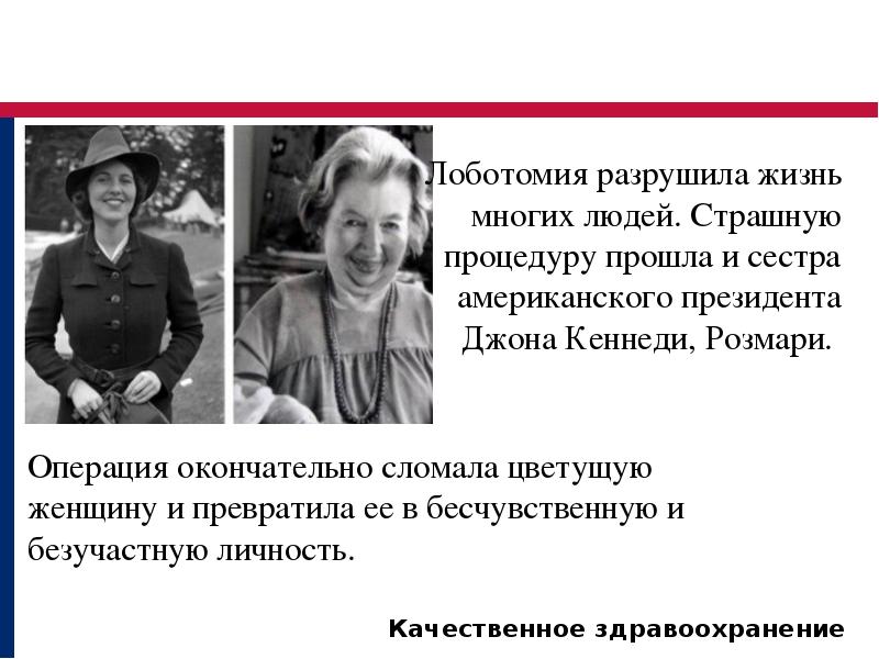 трансорбитальная лоботомия. префронтальная лейкотомия. транс орбитальная лоботомия. фронтальная лоботомия. трансорбитальная лоботомия.
