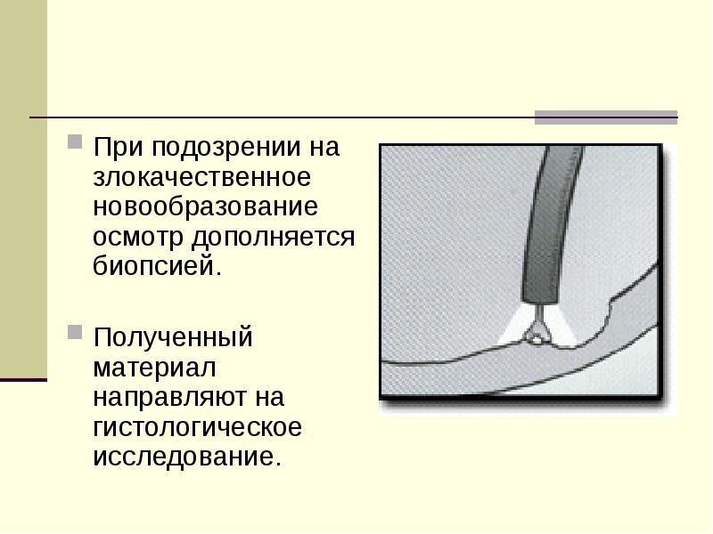 Материал направлен. При подозрении. При подозрении на злокачественную опухоль необходимо:. Характеристика полученного материала при биопсии. Жизненная исследования на подозрение новообразования.