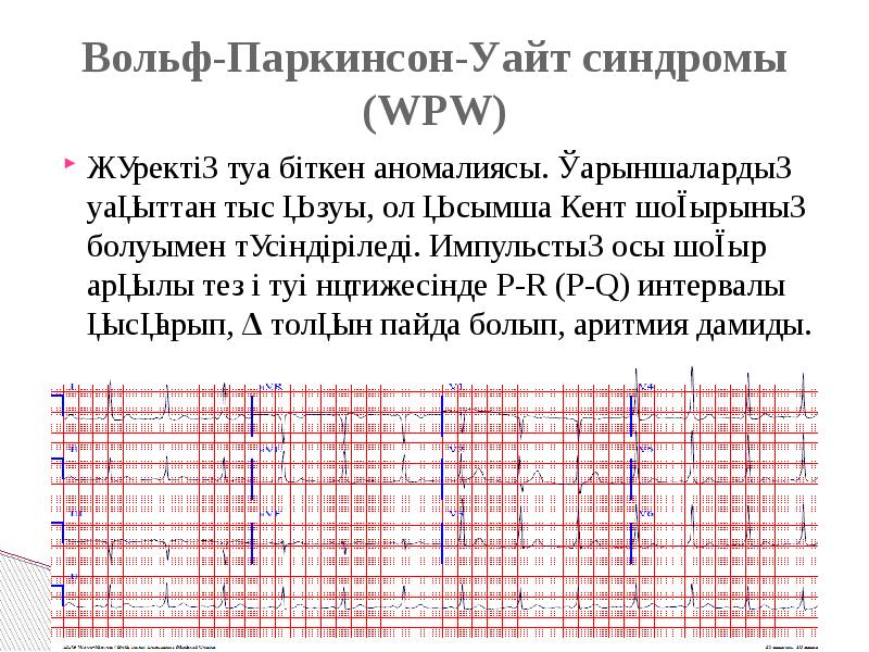 Впв синдром мкб 10. Впв синдром мкб 10