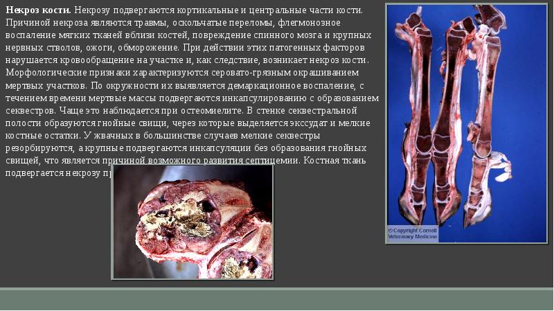 Патологическая анатомия заболеваний костей и суставов - презентация .