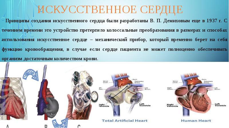 Проект на тему искусственные органы