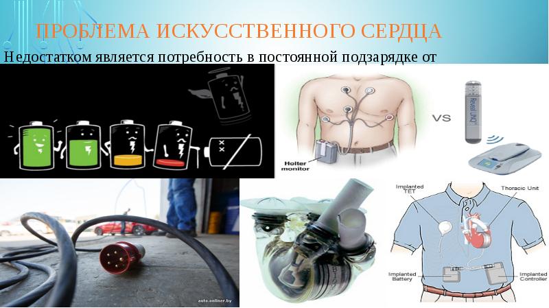 Искусственные органы презентация