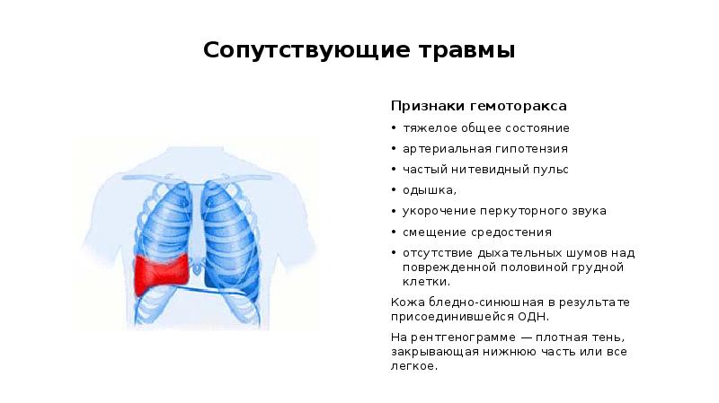 Гемоторакс клиническая картина