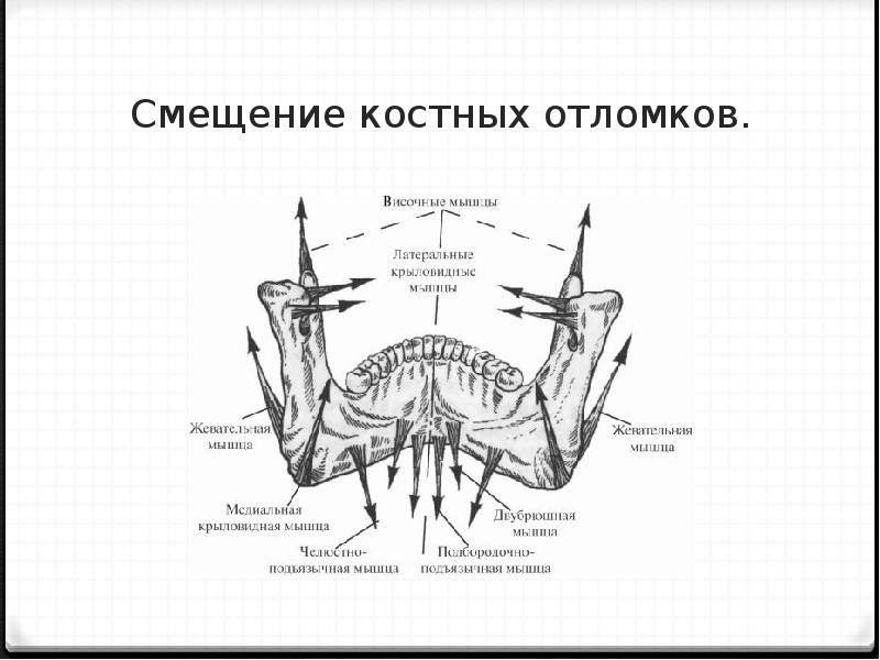 Ударился нижней челюстью